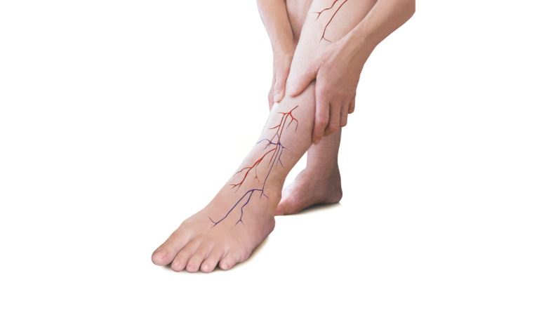 MECO Hand on Legfrom Promo Box Livewell2u
