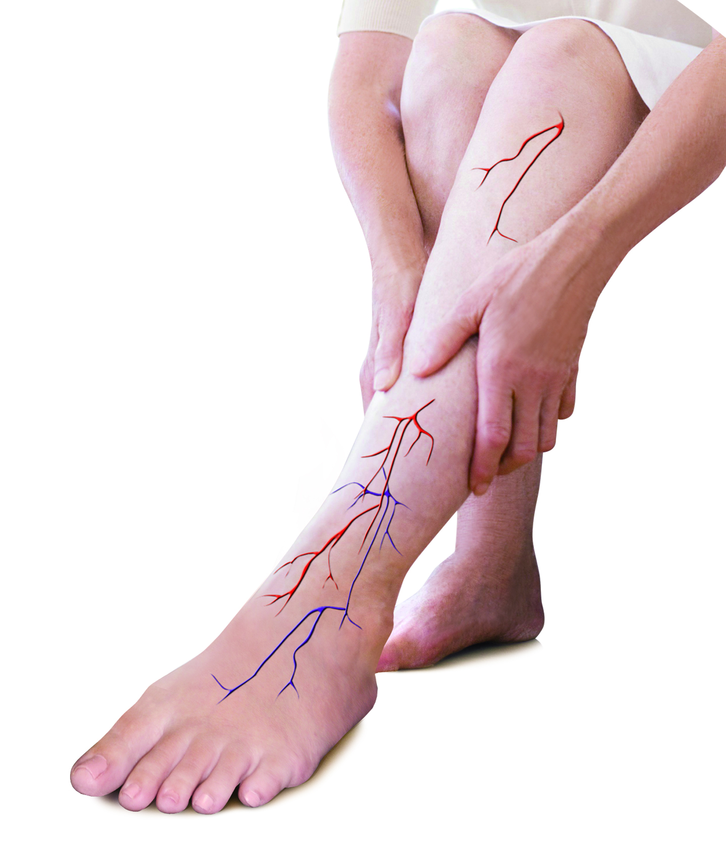 MECO Hand on Legfrom Promo Livewell2u