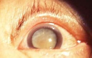 occusharp ageing eyes Livewell2u