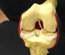 ostc msm cartilage Livewell2u